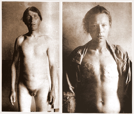 Barbat și femeie, după mutilarea rituală-sursa foto Wikipedia